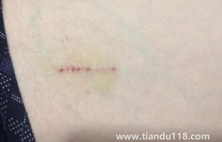 被貓抓了一下輕微破皮要打針嗎(被貓抓傷多少天過危險(xiǎn)期)(圖1) 被貓抓了一下輕微破皮要打針嗎1